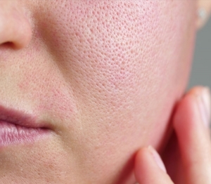 Large Pores and Makeup: Enhance Your Beauty Routine