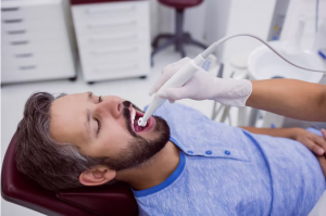 The Cost of Root Canal Treatment in Richmond: Factors to Consider