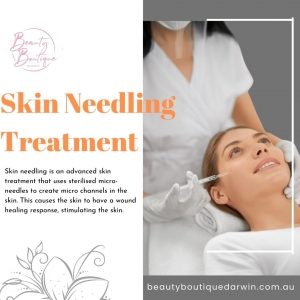 Skin Needling Treatment Darwin