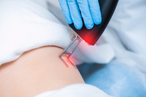 Breaking Taboos: Unveiling the Power of Laser Treatment for Piles