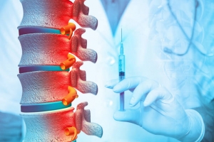 Sciatica Market Estimated To Witness High Growth Owing To Increasing Geriatric Population