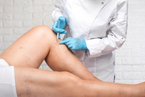 Beyond Beauty: Understanding Vein Health with Dr. Mahmoud Akrama, Vein Specialist