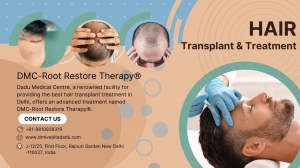 Can a Hair Transplant Cover Your Whole Head?