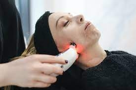 Limelight Laser: Illuminating Your Path to Radiant Skin