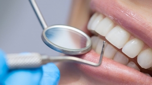 Tooth Extraction: Dubai's Recovery Timeline and Expectations