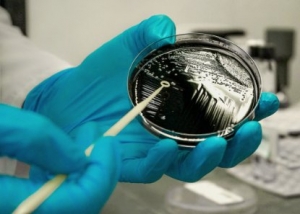 Legionella Testing is Estimated to Witness High Growth Owing to Increasing Waterborne Diseases