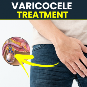 Best medicine for varicocele treatment