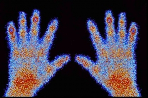 Radioactive Tracer Market is Estimated to Witness High Growth Owing to Growing Applications in Medical Diagnostics