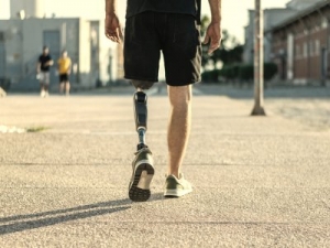 Prosthetic Legs Market is Estimated to Witness High Growth Owing to Increasing Road Accidents and Injuries