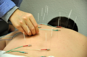 The Myths and Fact of Understanding Acupuncture in Physiotherapy