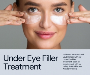 Under Eyes Filler Treatment in Delhi: Illuminate Your Gaze