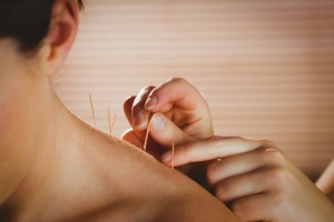 Precision Healing: Expertise in Dry Needling Therapy Grande Prairie