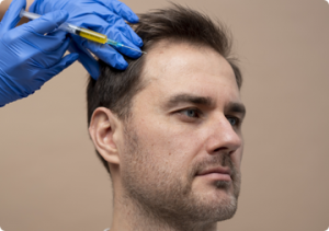 Understanding FUE Hair Transplant Cost: A Comprehensive Guide by Cosmeticoplasty