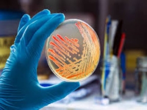 Legionella Control: Innovative Approaches to Efficient Testing and Prevention