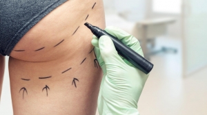 Improve your bends with a Brazilian Butt Lift in Dubai! Accomplish the ideal shape and form you've generally wanted.