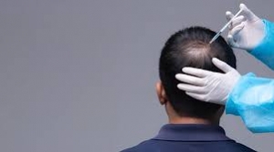 Dubai's Best-Kept Secret: Revealing Cost of Hair Transplant in Dubai 