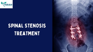 Navigating Narrow Paths: Understanding Spinal Stenosis