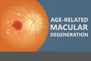 Shining A Light on Macular Degeneration Awareness Month