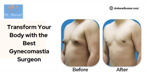 Transform Your Body with the Best Gynecomastia Surgeon