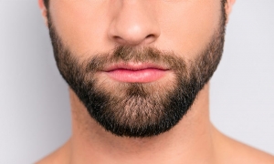 Journey to Beard Rejuvenation: Hair Transplant in Dubai