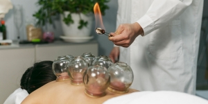Discover top-notch cupping therapy in Dubai for ultimate relaxation and rejuvenation.
