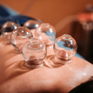 Revitalize in the comfort of home with our Hijama service in Dubai!