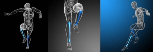 Orthobiologics: Understanding the Science of Healing