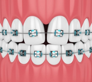 Tooth Regeneration: A Promising Future in Dentistry 