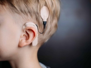 Advancements in Cochlear Implant Technology: Shaping the Future of Hearing Solutions