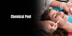 How Do Chemical Peels Work?