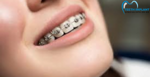 The Evolution of Orthodontic Treatment in the UK: A Comprehensive Overview