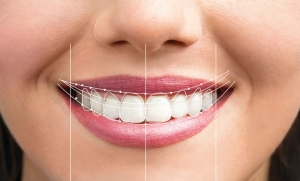 San Francisco Dentist: Top Tips for Perfect Oral Health