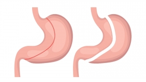 Dubai's Top-Rated Gastric Sleeve Surgery Clinic