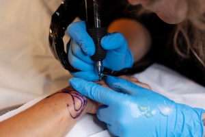 Unveiling the Painless Journey: Auckland's Premier Destination for Tattoo Removal