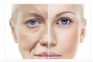 Understanding the Procedure: Step-by-Step Process of Stemcell Facelifts