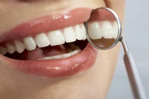 The Art of Composite Bonding: Elevating Smiles