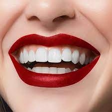 Hollywood Smile Makeover: Crafting Perfection, One Smile at a Time