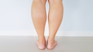 Achieving Sleek Silhouettes: The Ultimate Guide to Calf Reduction