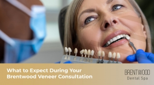 What to Expect During Your Brentwood Veneer Consultation