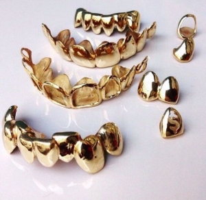 Gleaming Gold Dental Implants: Dubai's Fashion Statement