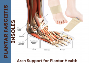 Understanding the Importance of Plantar Fasciitis Insoles and Arch Support for Plantar Health