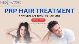 PRP Hair Treatment: A Natural Approach To Hair Loss