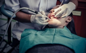 Everything you should know about Root Canal Treatment