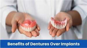 Dentures: Cost-effective option