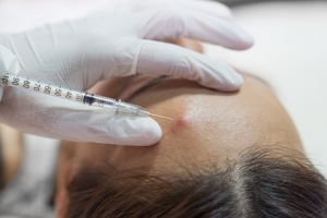 Smooth Skin Ahead: Keloid Injections in Dubai