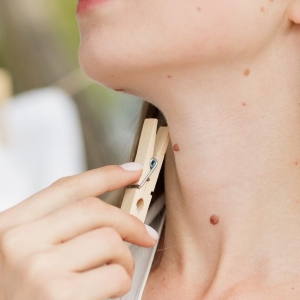 Is Skin Tag Removal Quick and Safe?