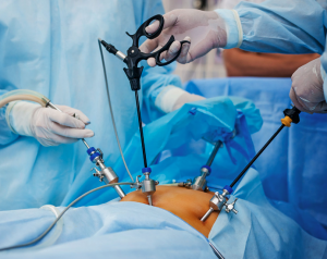 Bariatric surgery devices Market Share, Trend, Segmentation and Forecast 2031