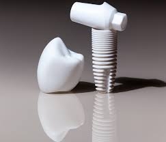 Why Zirconia Implants are Gaining Popularity in Dubai