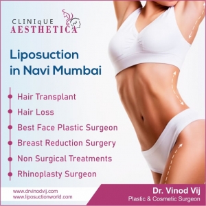 Transform Your Body with Expert Liposuction in Navi Mumbai by Dr. Vinod Vij