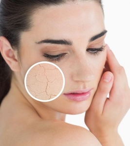 Acne Scars Treatment in Dubai: Popping Pimples Can Prevent Acne Scars